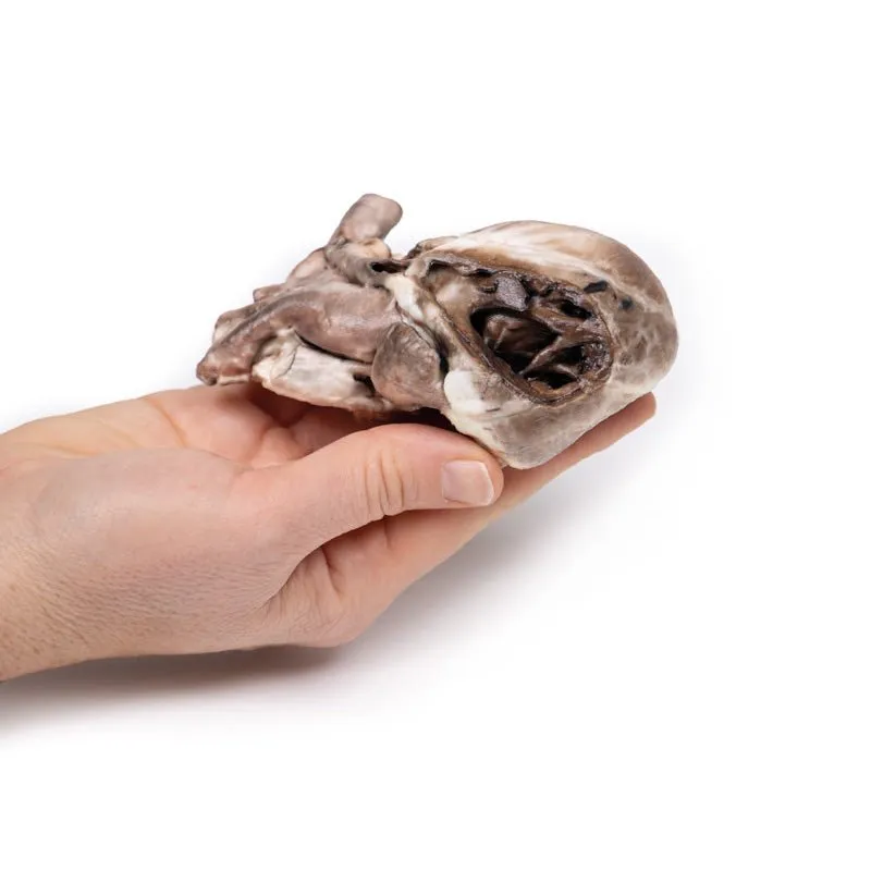 3D Printed Tetralogy of Fallot